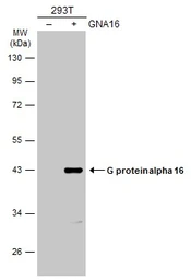 Anti-G protein alpha 16 antibody used in Western Blot (WB). GTX118385