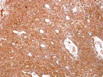 Anti-GSTO1 antibody used in IHC (Paraffin sections) (IHC-P). GTX118439