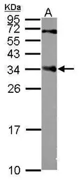 Anti-CENPP antibody used in Western Blot (WB). GTX118443