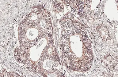 Anti-MTMR9 antibody used in IHC (Paraffin sections) (IHC-P). GTX118447