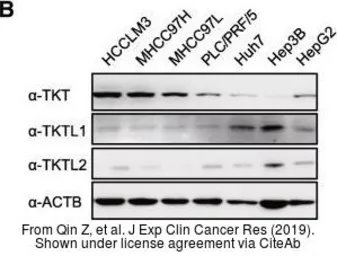 Anti-TKTL2 antibody [N1N3] used in Western Blot (WB). GTX118468