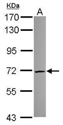 Anti-TKTL2 antibody [N1N3] used in Western Blot (WB). GTX118468