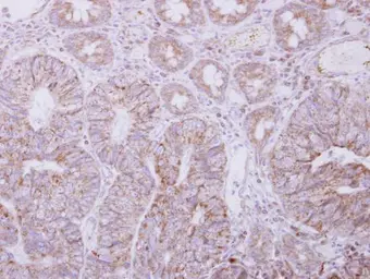 Anti-PIGO antibody [N2N3] used in IHC (Paraffin sections) (IHC-P). GTX118512