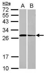 Anti-Syntaxin 3 antibody [N1C2] used in Western Blot (WB). GTX118549