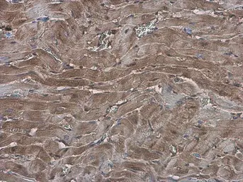 Anti-EFHA1 antibody used in IHC (Paraffin sections) (IHC-P). GTX118555