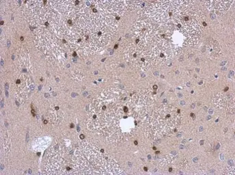 Anti-ADI1 antibody used in IHC (Paraffin sections) (IHC-P). GTX118578