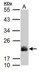 Anti-ADI1 antibody used in Western Blot (WB). GTX118578