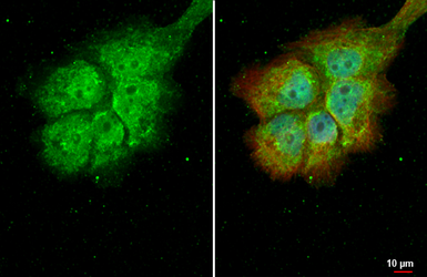 Anti-RBPMS antibody used in Immunocytochemistry/ Immunofluorescence (ICC/IF). GTX118619