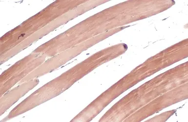 Anti-TRIM72 antibody used in IHC (Paraffin sections) (IHC-P). GTX118625