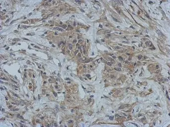 Anti-GBP5 antibody [N3C3] used in IHC (Paraffin sections) (IHC-P). GTX118635