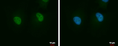 Anti-AIMP2 antibody [N2C3] used in Immunocytochemistry/ Immunofluorescence (ICC/IF). GTX118650