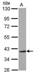 Anti-AIMP2 antibody [N2C3] used in Western Blot (WB). GTX118650