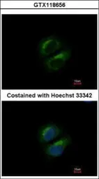 Anti-PCBP3 antibody [N1C2] used in Immunocytochemistry/ Immunofluorescence (ICC/IF). GTX118656