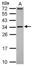 Anti-MRPL10 antibody [N1C2] used in Western Blot (WB). GTX118664