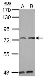 Anti-KIAA0020 antibody [C1C3] used in Western Blot (WB). GTX118675