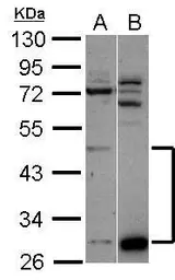 Anti-ZNF410 antibody [N1C1] used in Western Blot (WB). GTX118703