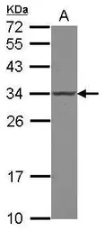 Anti-POLR2C antibody [N1C3-2] used in Western Blot (WB). GTX118715