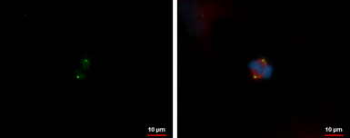 Anti-HAUS1 antibody [N1C3] used in Immunocytochemistry/ Immunofluorescence (ICC/IF). GTX118733