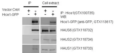 Anti-HAUS1 antibody [N1C3] used in Western Blot (WB). GTX118733