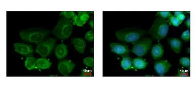 Anti-HAUS2 antibody [N1C3-2] used in Immunocytochemistry/ Immunofluorescence (ICC/IF). GTX118734