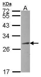 Anti-HAUS2 antibody [N1C3-2] used in Western Blot (WB). GTX118734