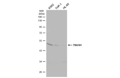 Anti-TSG101 antibody used in Western Blot (WB). GTX118736