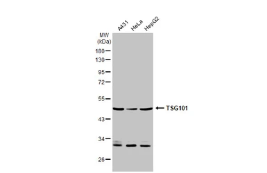 Anti-TSG101 antibody used in Western Blot (WB). GTX118736