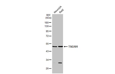 Anti-TSG101 antibody used in Western Blot (WB). GTX118736