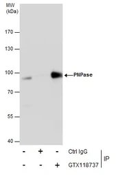 Anti-PNPase antibody used in Immunoprecipitation (IP). GTX118737