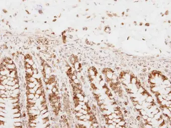 Anti-PNPase antibody used in IHC (Paraffin sections) (IHC-P). GTX118737