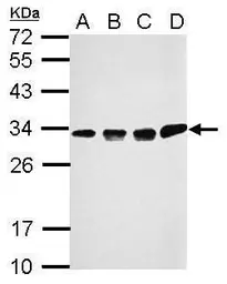 Anti-CCDC44 antibody used in Western Blot (WB). GTX118757