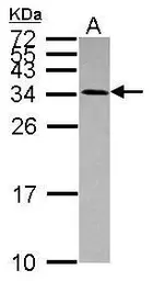 Anti-USE1 antibody used in Western Blot (WB). GTX118767