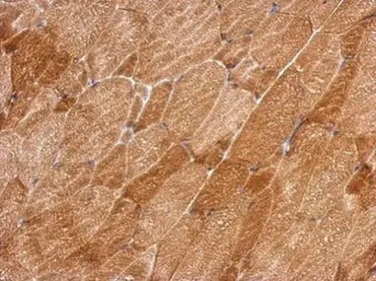 Anti-QTRT1 antibody used in IHC (Paraffin sections) (IHC-P). GTX118778