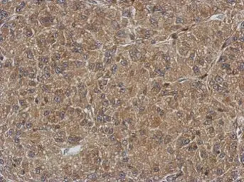 Anti-QTRT1 antibody used in IHC (Paraffin sections) (IHC-P). GTX118778
