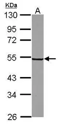 Anti-SYT6 antibody [N1C2] used in Western Blot (WB). GTX118843