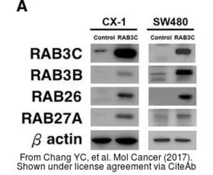 Anti-RAB26 antibody [N2C3-2] used in Western Blot (WB). GTX118872