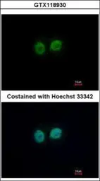 Anti-RCC2 antibody [N1C1] used in Immunocytochemistry/ Immunofluorescence (ICC/IF). GTX118930