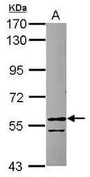 Anti-RCC2 antibody [N1C1] used in Western Blot (WB). GTX118930