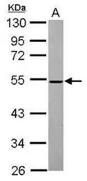 Anti-MINA53 antibody [N1N3] used in Western Blot (WB). GTX118937