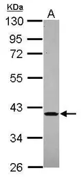 Anti-AIMP2 antibody [N1C1] used in Western Blot (WB). GTX118947