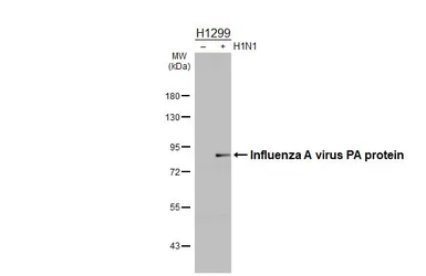 Anti-Influenza A virus PA protein antibody used in Western Blot (WB). GTX118991