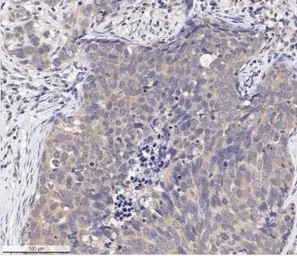 Anti-AKT (phospho Ser473) antibody [104A282] used in IHC (Paraffin sections) (IHC-P). GTX11901