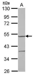 Anti-YARS2 antibody used in Western Blot (WB). GTX119029