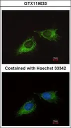 Anti-MRPS23 antibody used in Immunocytochemistry/ Immunofluorescence (ICC/IF). GTX119033