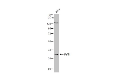 Anti-FVT1 antibody [N2C3] used in Western Blot (WB). GTX119050