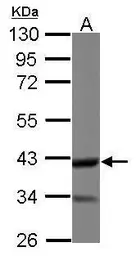 Anti-DOC2A antibody [N2C3] used in Western Blot (WB). GTX119085