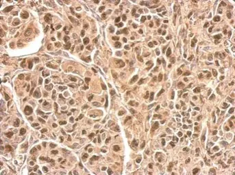 Anti-HRSP12 antibody used in IHC (Paraffin sections) (IHC-P). GTX119107