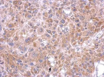 Anti-SPOCK3 antibody [N2C3] used in IHC (Paraffin sections) (IHC-P). GTX119149