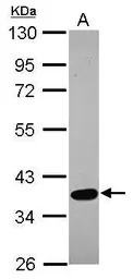 Anti-SPOCK3 antibody [N2C3] used in Western Blot (WB). GTX119149