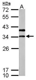 Anti-V-ATPase D antibody used in Western Blot (WB). GTX119155